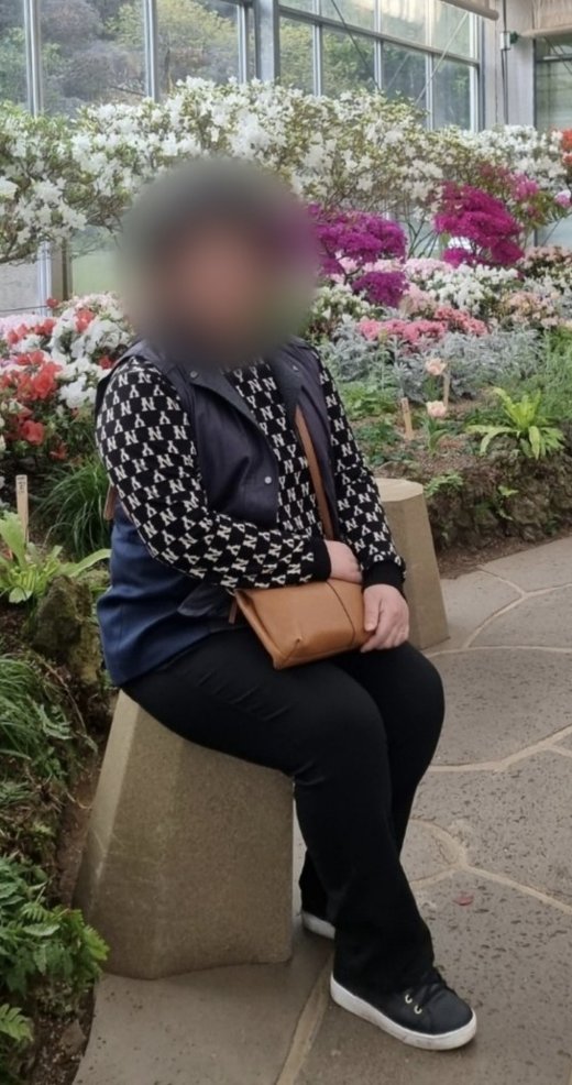 28kg 감량 회원의 이전 모습(얼굴 비공개)