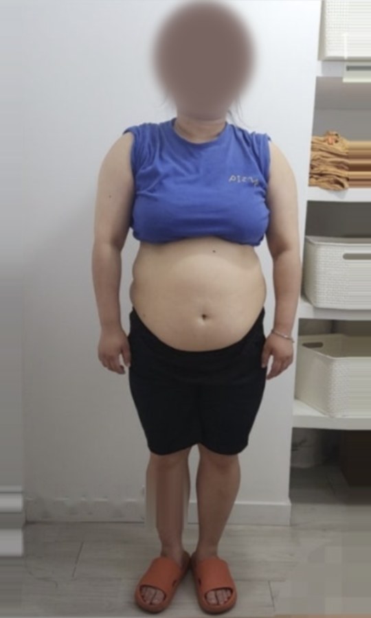 20kg 감량 회원의 이전 모습(얼굴 비공개)
